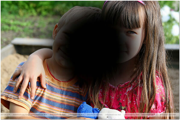 degeneracion macular